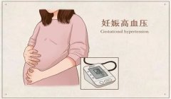 妊娠高血压综合征的症状、危害与护理要点