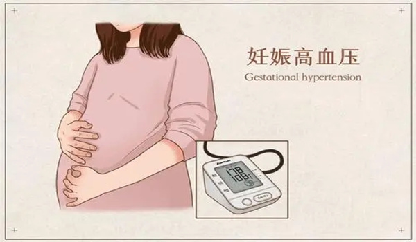 妊娠高血压综合征的症状