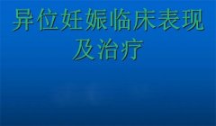 异位妊娠的表现与原因是什么，如何护理与治疗