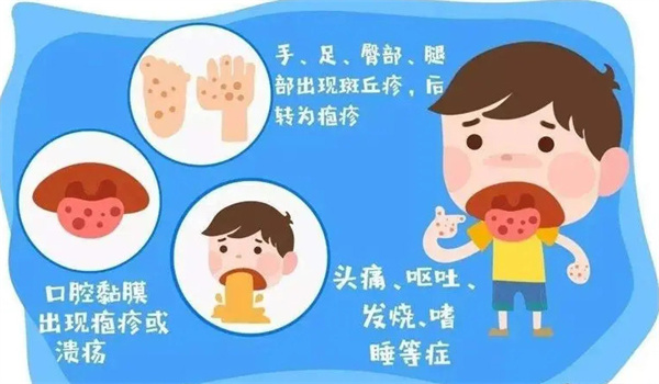 小孩手足口病的传播途径