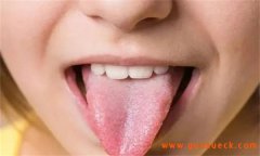 望舌察病的方法与要点简介