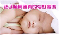 婴儿“睡扁头”的危害及要注意的问题