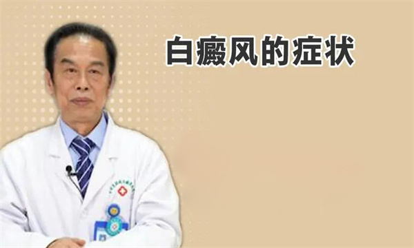 白癜风症状表现